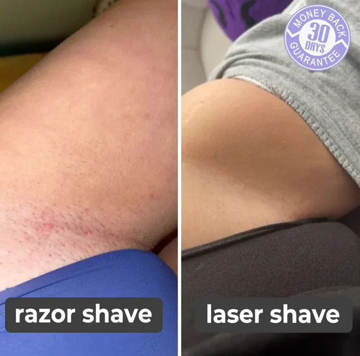 Painless Laser Touch Hair Removal Epilator